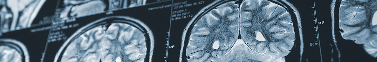 Máster de Formación Permanente en Neurocirugía Funcional y Estereotáctica (VI edición)